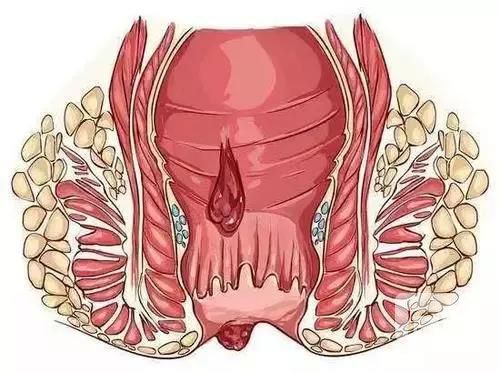 山西肛泰肛肠医院：肛门疼痛原因多，看看你属于哪一种