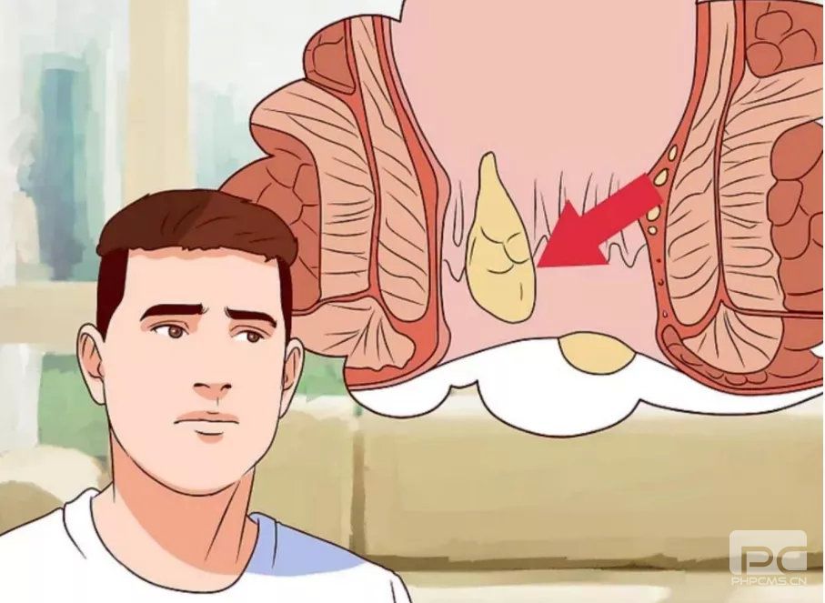 山西肛泰肛肠医院：有痔青年，快来看看你是哪种痔疮？