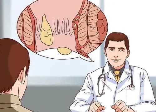 山西肛泰肛肠医院：“菊花”上面长了包？