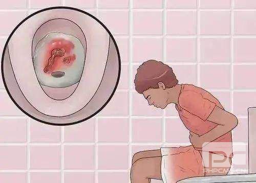 山西肛泰肛肠医院：痔疮如何自测？