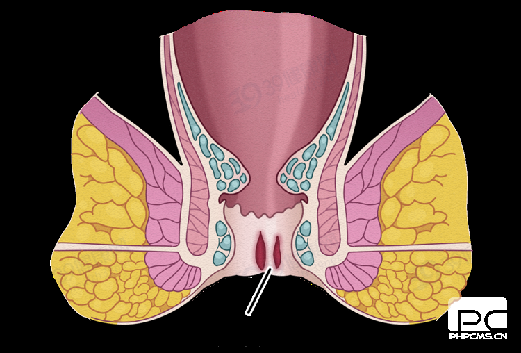 山西肛泰肛肠医院：肛裂不止排便疼痛出血那么简单！
