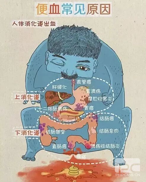 山西肛泰肛肠医院：带你走出痔疮的误区