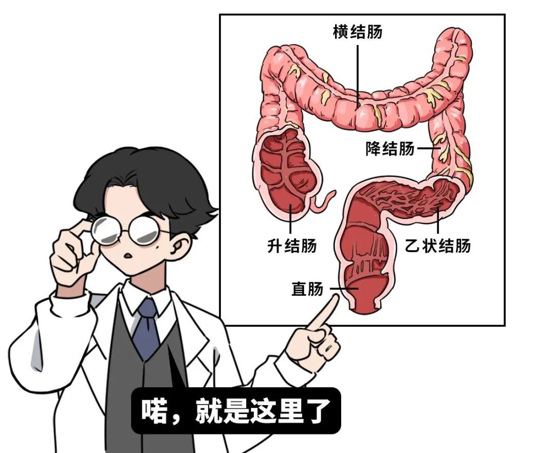 山西肛泰肛肠医院：便血了，是痔疮还是肠癌？