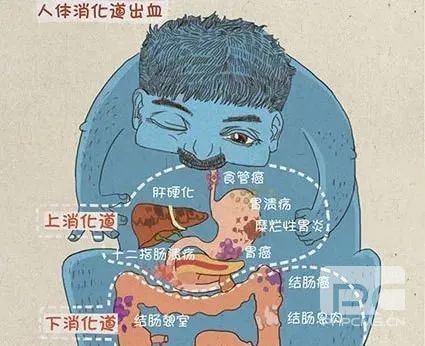 山西肛泰肛肠医院：引起便血的十大疾病