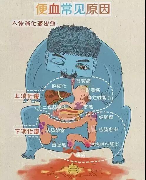 山西肛肠医院：便秘不是病，解不出来真要命！