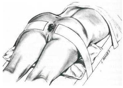 山西肛泰肛肠医院：久坐容易患痔疮，该怎么治疗好