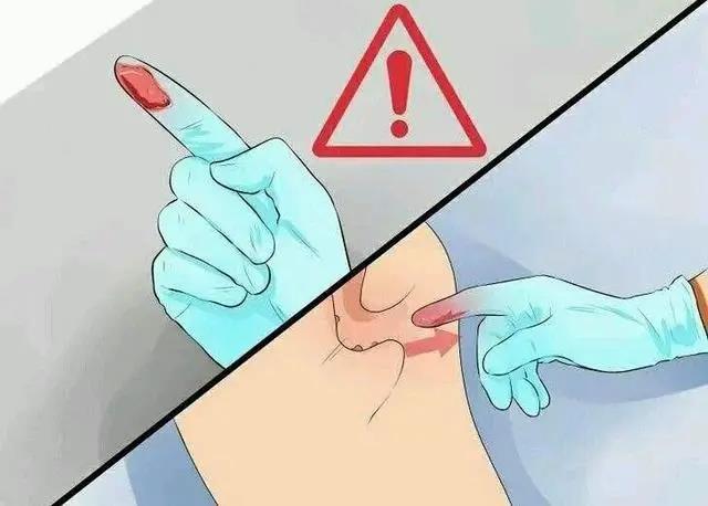 山西肛泰肛肠医院：便血原因个不同 找准出血点很关键