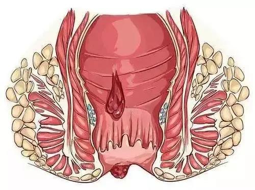 山西肛泰肛肠医院：肛裂能自己长好吗？肛裂该怎么办？