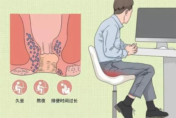 山西肛泰肛肠医院：做完痔疮手术需要注意什么？