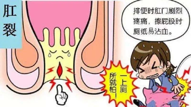山西肛泰肛肠医院：肛裂一直不好，反反复复怎么办？