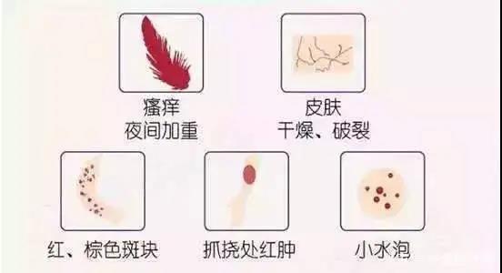 山西肛泰肛肠医院：肛周湿疹的预防措施