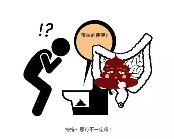山西肛泰肛肠医院：排便出血？6个细节教你识别痔疮还是直肠癌